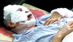 Nghi bị 'cắm sừng', người vợ mua 50.000 axit về 'xử' chồng